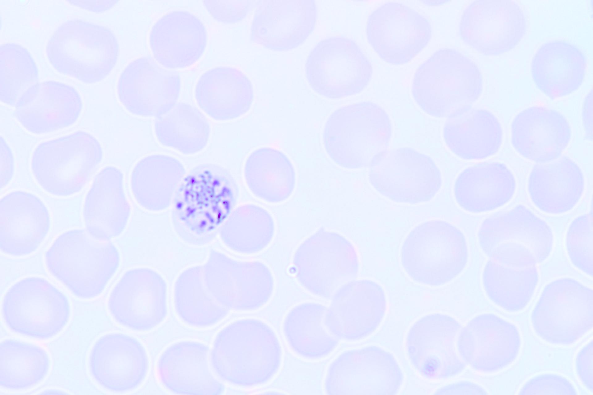 Pathology