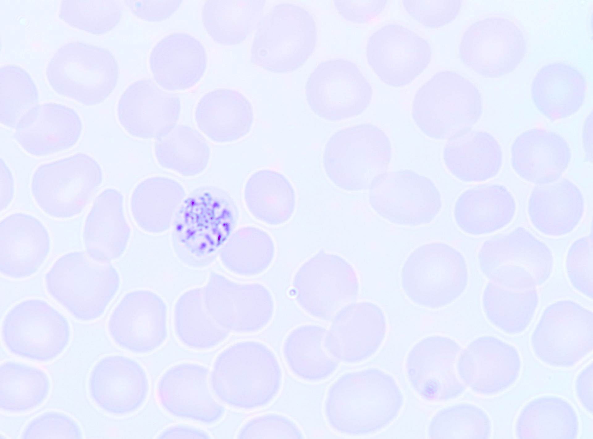 Pathology