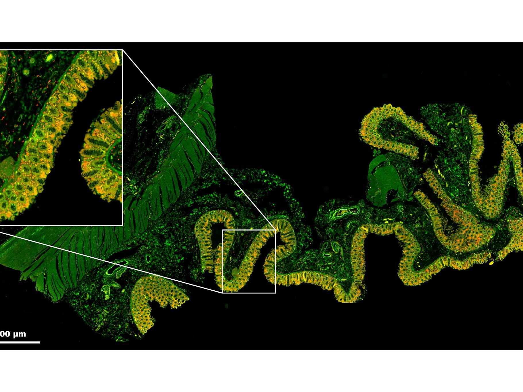 ZEISS spatial biology tools support multiplex imaging and analysis to uncover tissue-level insights in metabolic disease research.