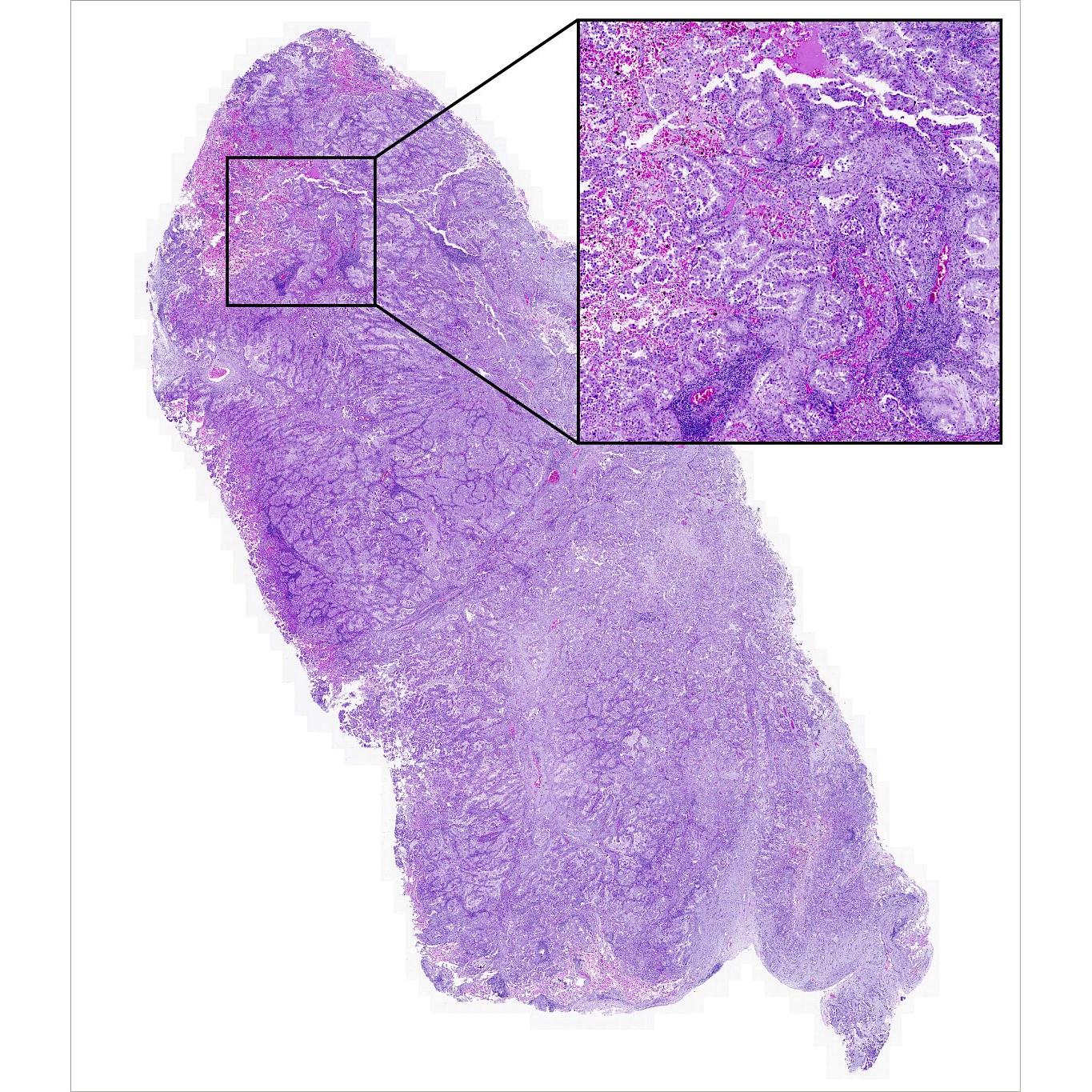 Pathology