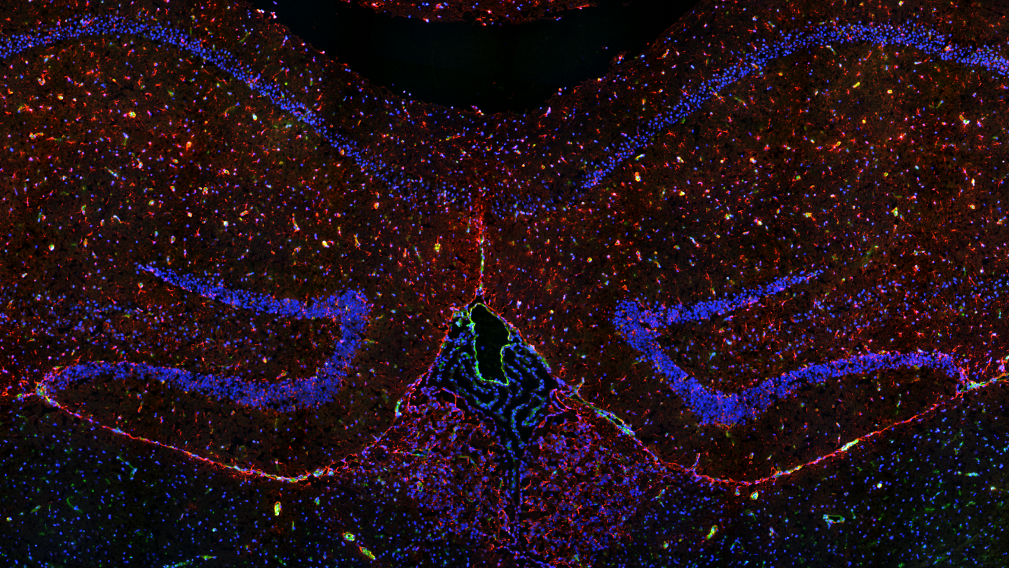 Mouse brain, 5 μm cryo section, qDOT labeled: DAPI, CD31(endothel); GFAP (astrocytes)