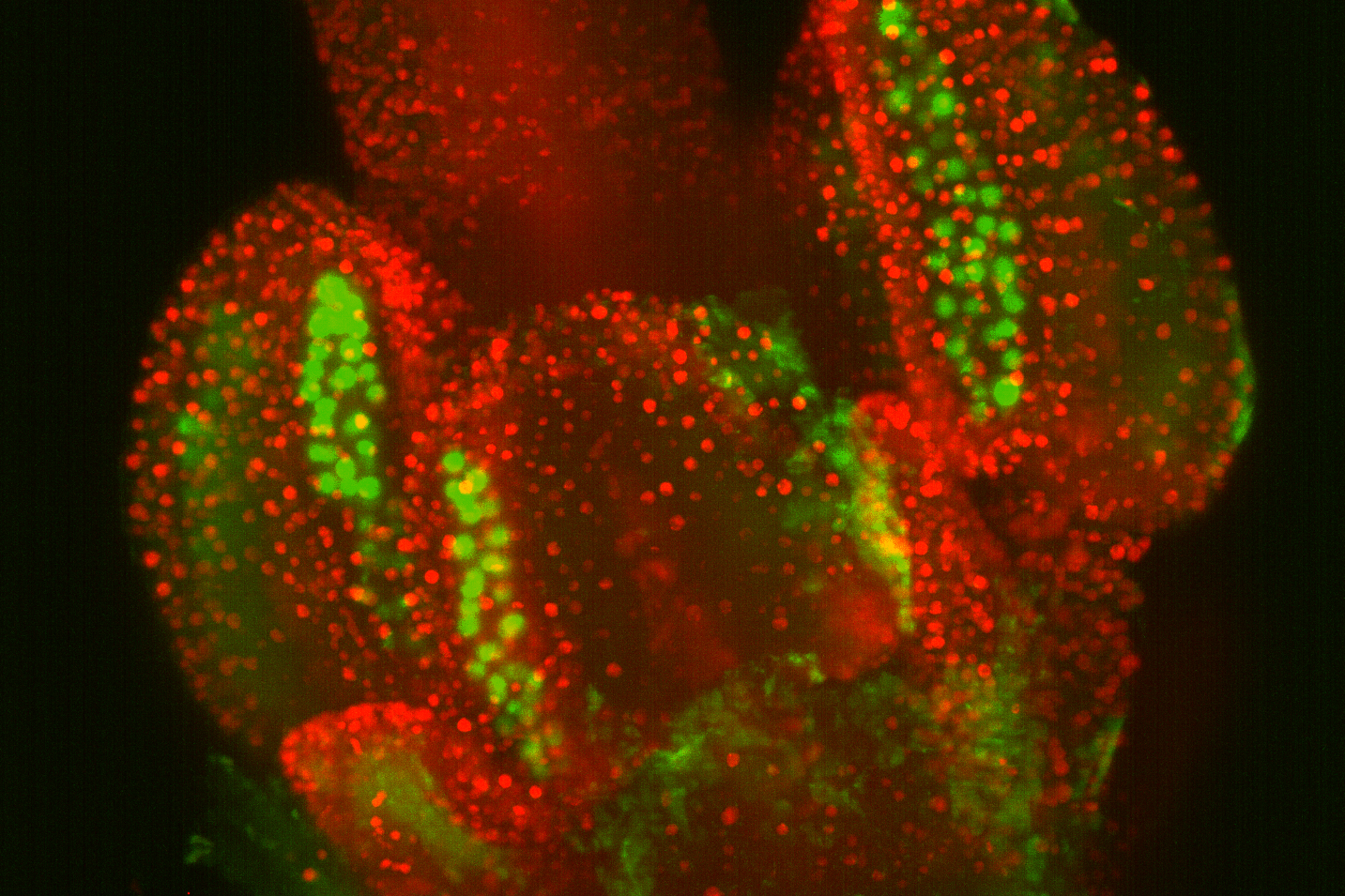 Development of  Arabidopsis flowers