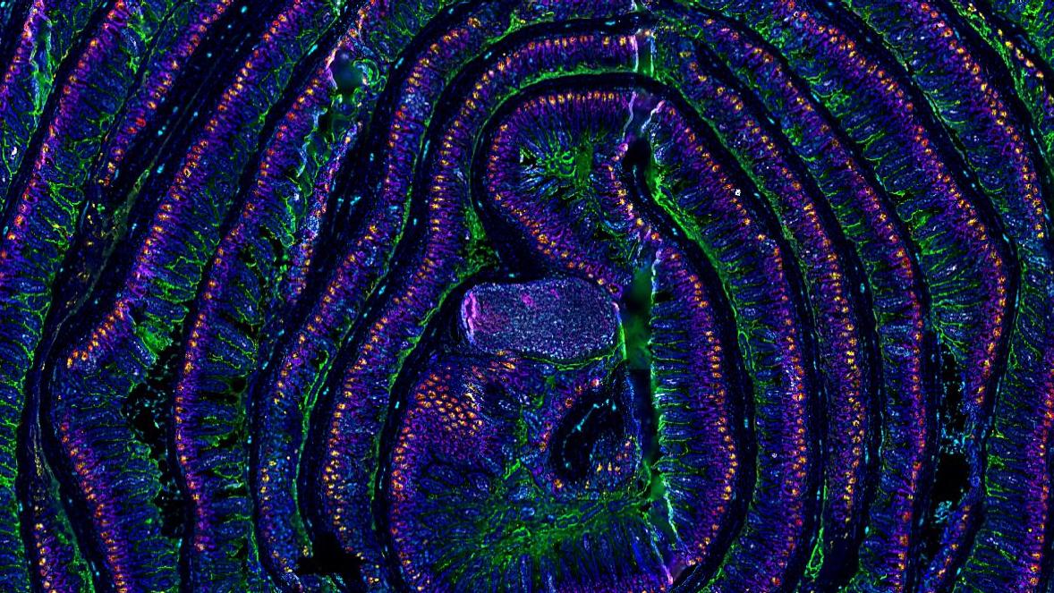 5 µm section of a formalin fixed paraffin-embedded mouse small intestine swiss roll. Section was stained with a 14 CODEX antibody panel designed to visualize intestinal stem and enteroendocrine cells (Lysozyme in red, villin in green, MHCII in gray, vimentin in cyan, Ki67 in magenta, and Olfm4 in yellow). Blue signals correspond to DAPI nuclear staining. Acquisition was done with a ZEISS Axio Observer microscope and processing with the Akoya CODEX Processor. 