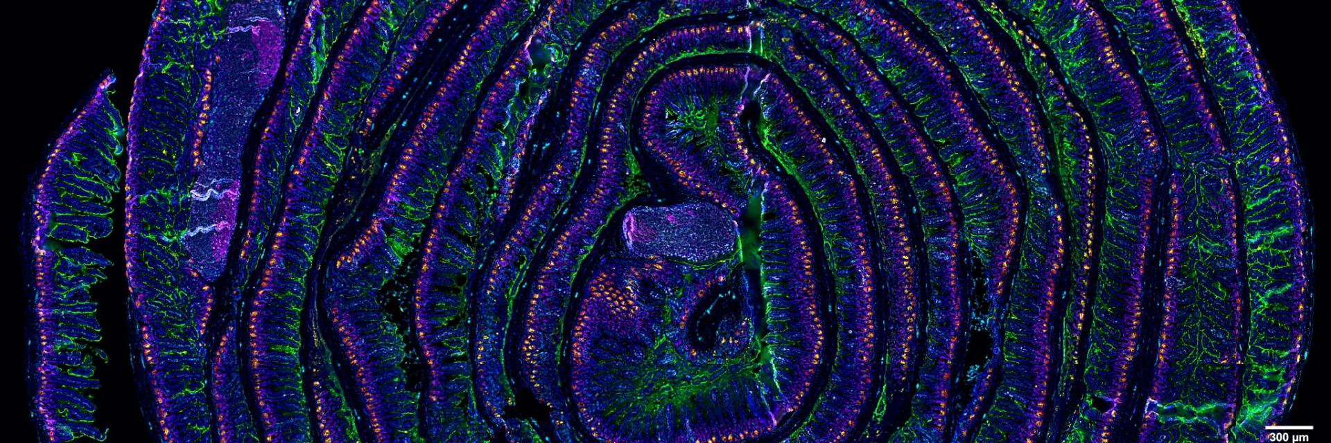 5 µm section of a formalin fixed paraffin-embedded mouse small intestine swiss roll. Section was stained with a 14 CODEX antibody panel designed to visualize intestinal stem and enteroendocrine cells (Lysozyme in red, villin in green, MHCII in gray, vimentin in cyan, Ki67 in magenta, and Olfm4 in yellow). Blue signals correspond to DAPI nuclear staining. Acquisition was done with a ZEISS Axio Observer microscope and processing with the Akoya CODEX Processor. 