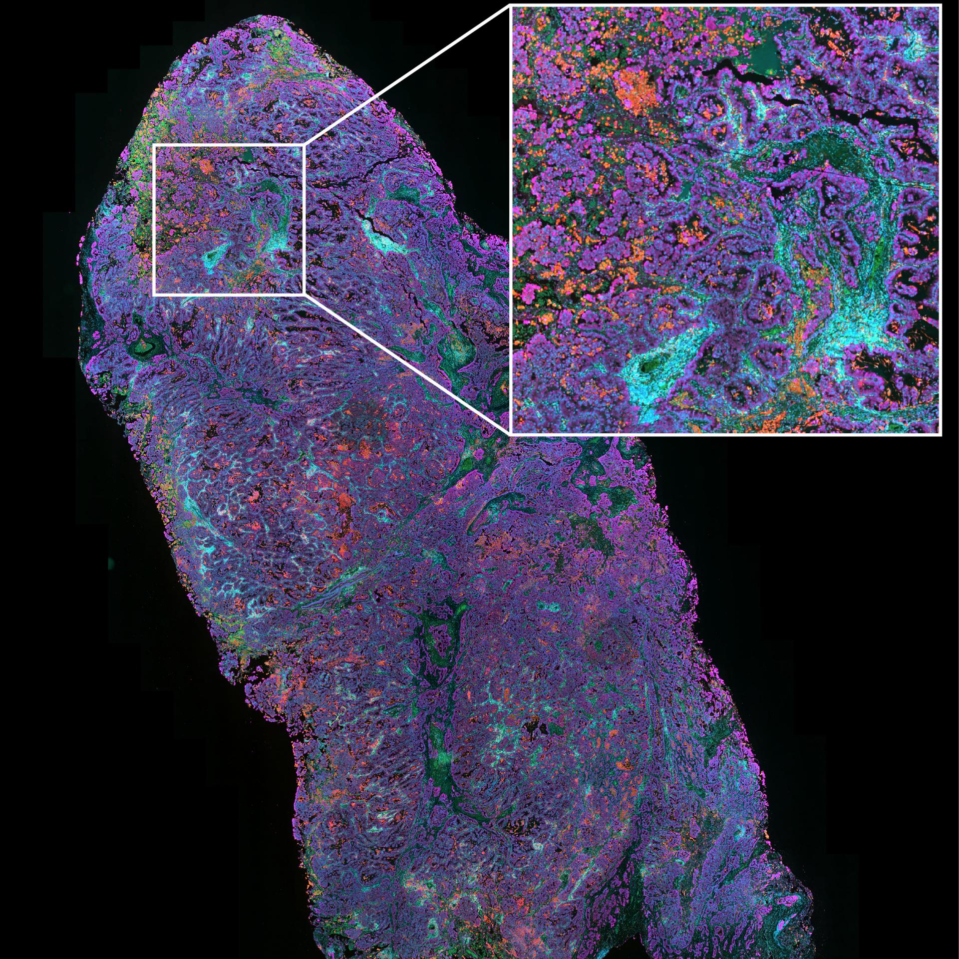 Tissue Microscopy