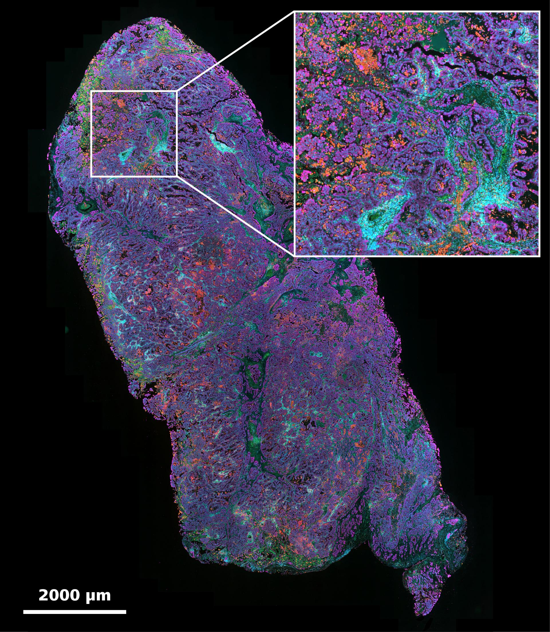 Tissue Microscopy