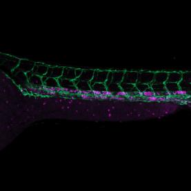 zebrafish Sample courtesy of B. Schmid, DZNE Munich, Germany 