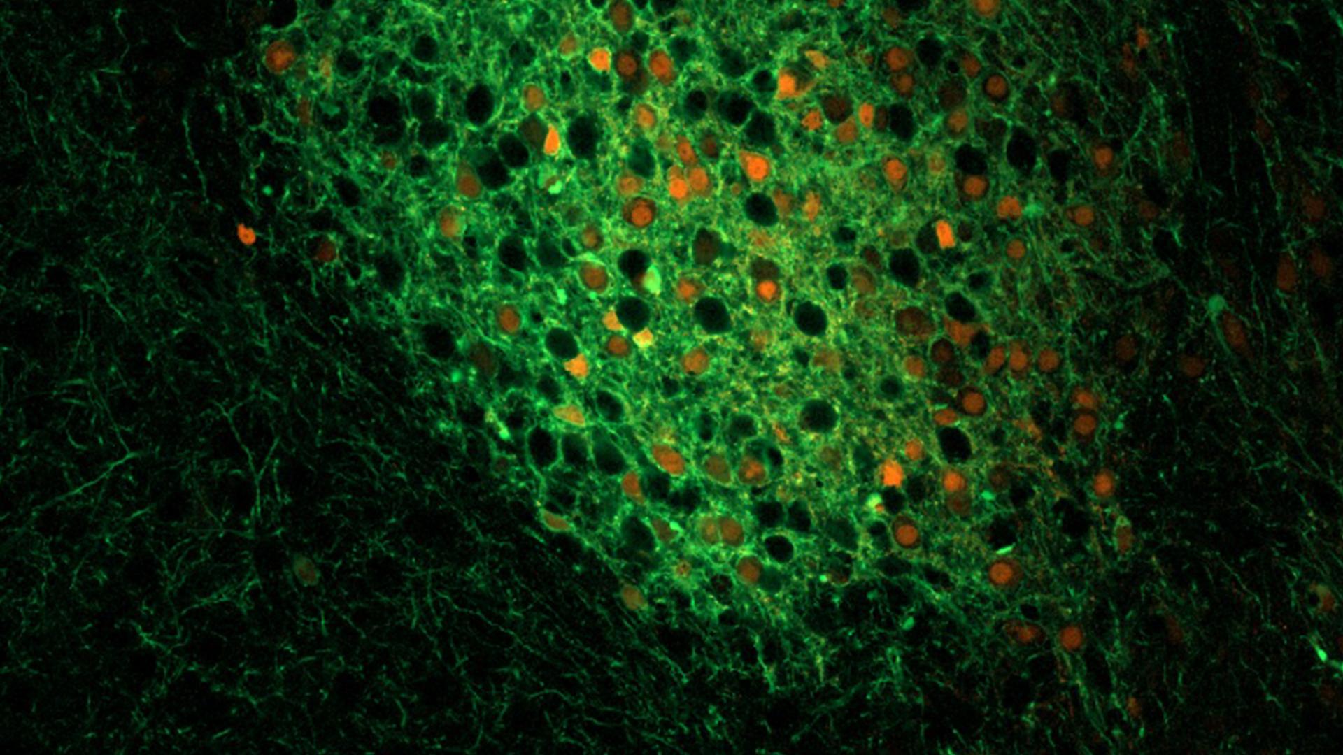 Connections between inhibitory somatostatin neurons onto each other and distant targets.