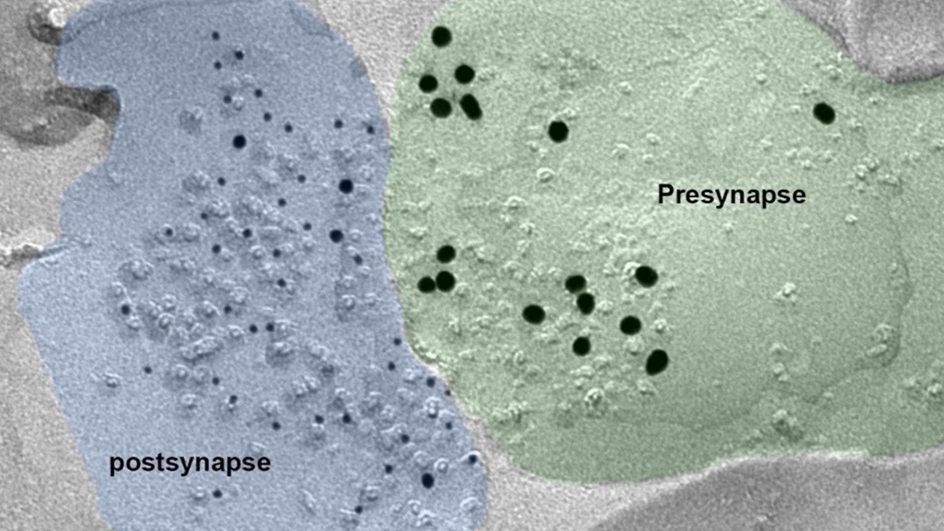 A synapse of an ASD (Autism Spectrum Disorder) model