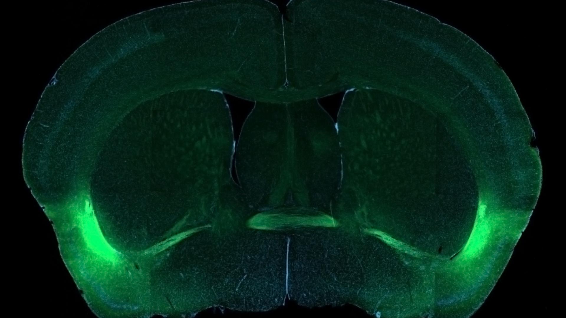ASD model in the amygdala shows reduced axonal outgrowth and interhemispheric connection.