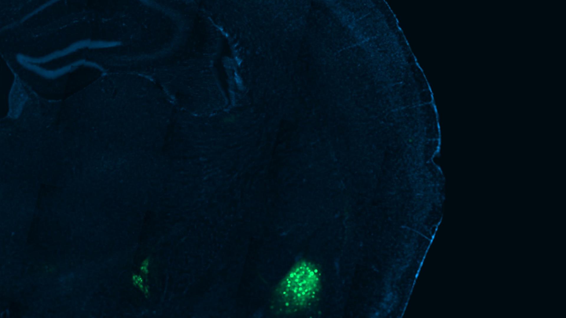Neurons in the amygdala