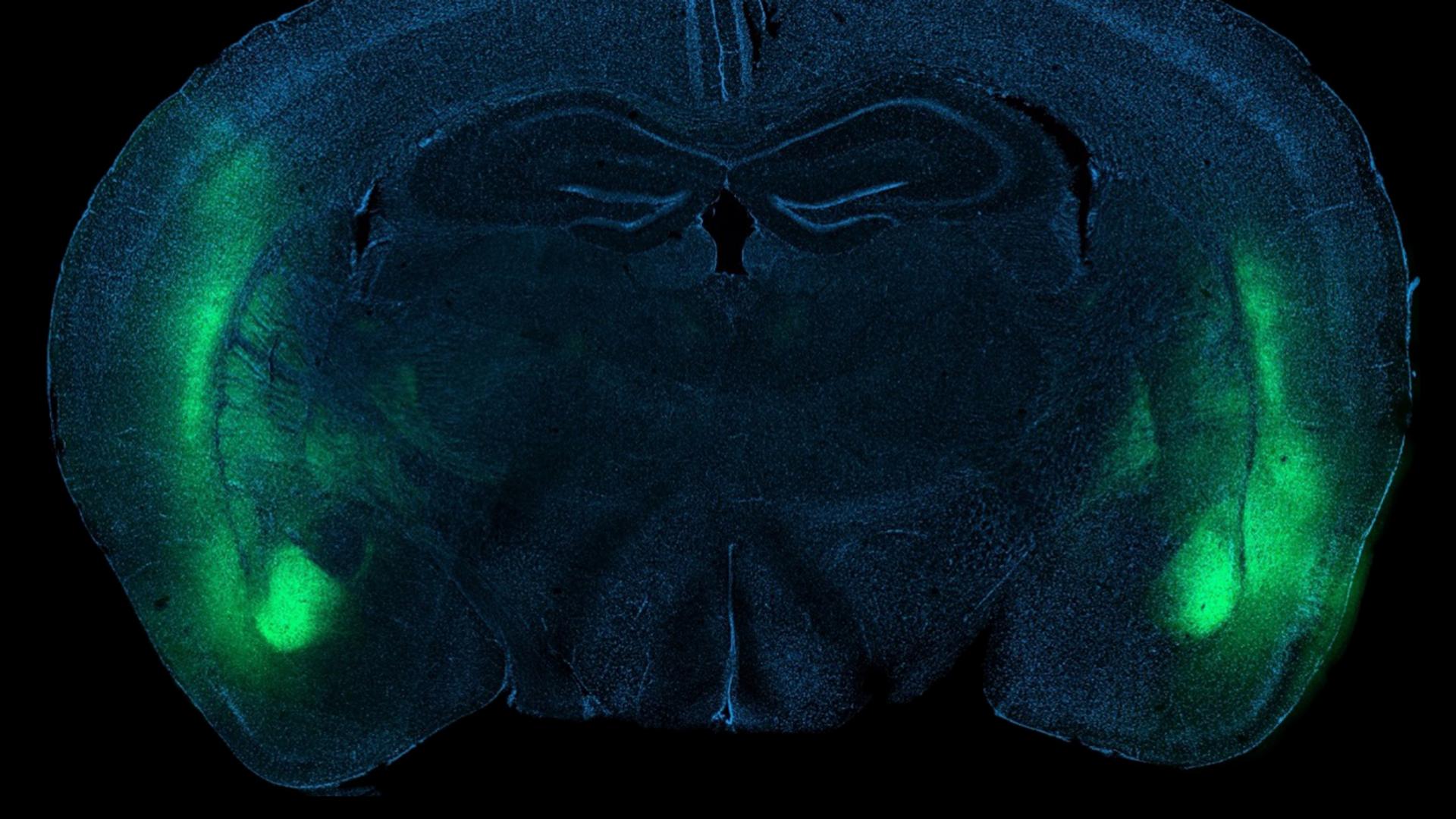 A better look at synapses