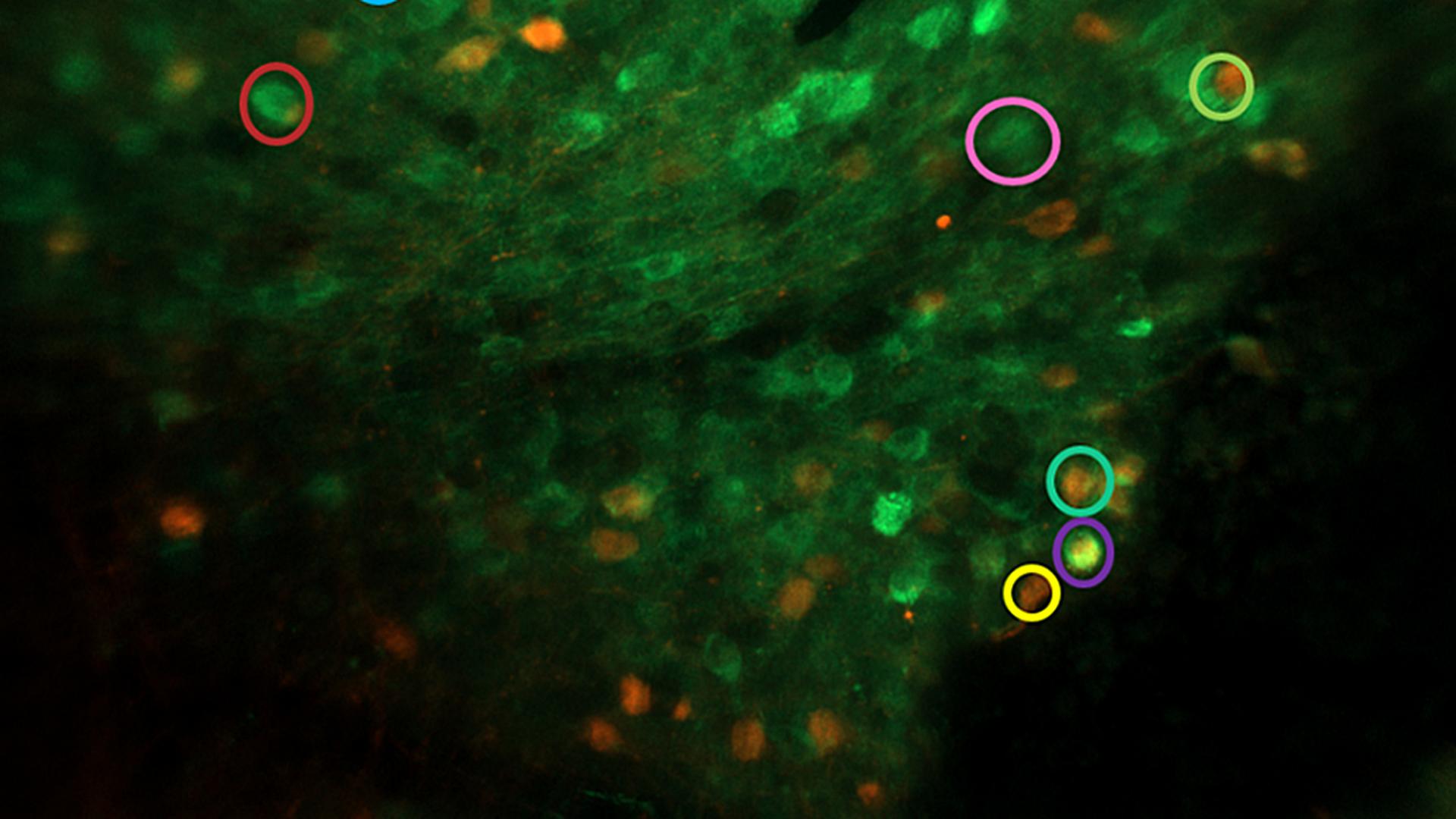 Measuring activity of subtypes of neurons in mice exposed to cannabinoids in adolescence. 