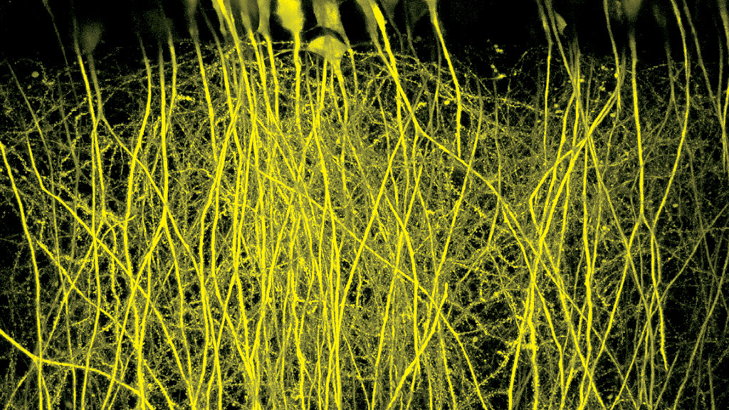 ZEISS neuropathology applications