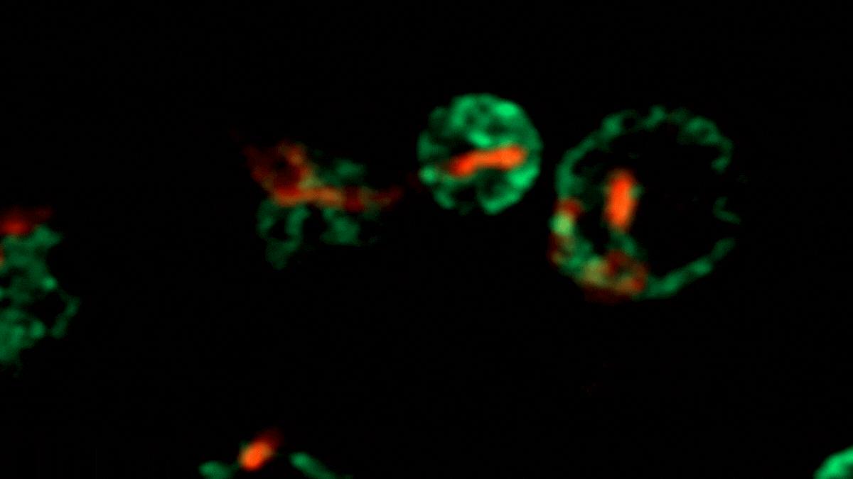 ER mitochondria contact sites in budding yeast cells