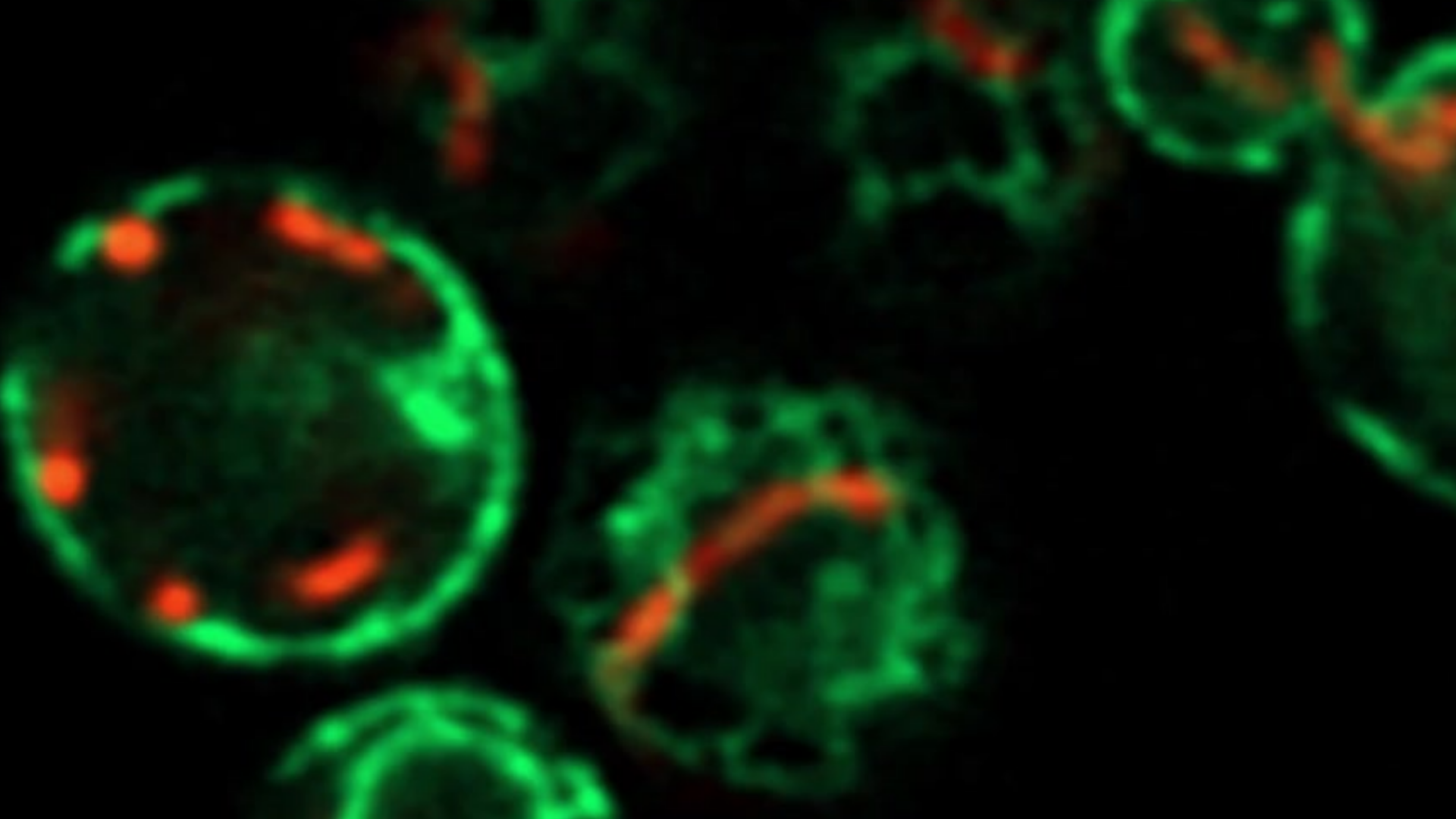 ER mitochondria contact sites in budding yeast cells