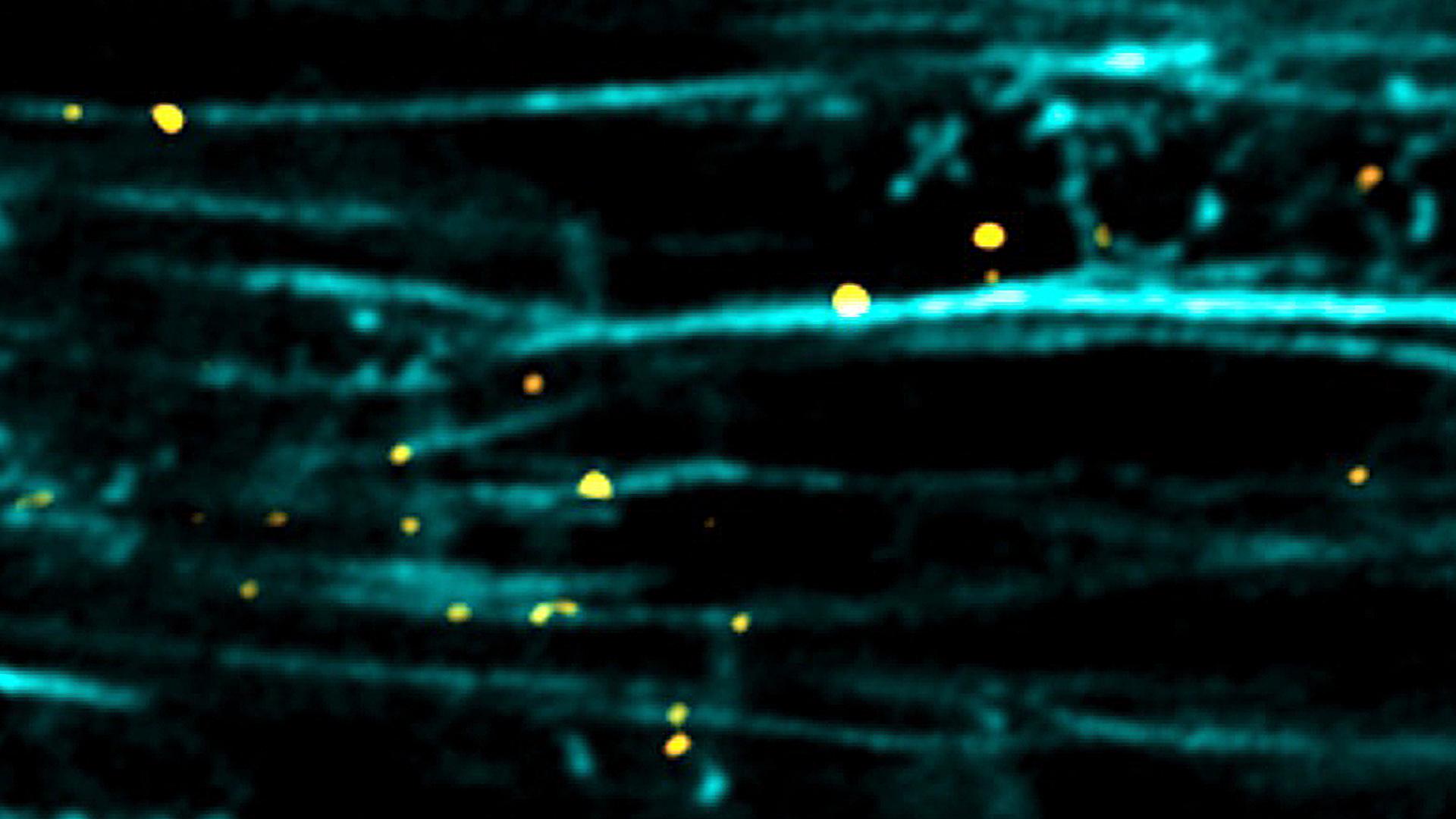 Microtubules (black) serve as the tracks by which the ribosomes and mRNAs (yellow) are moved around the heart muscle cell. 