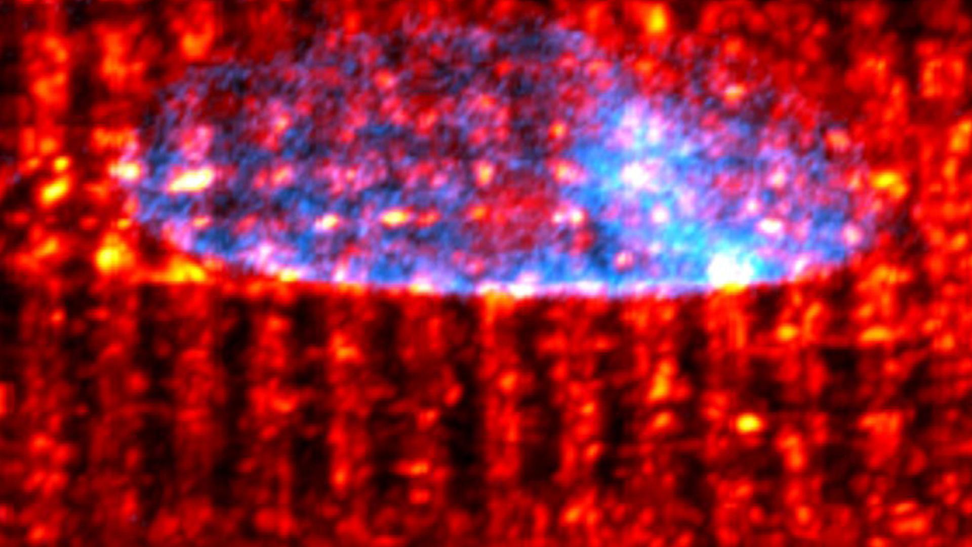 Microtubules serve as the tracks by which the protein translation machinery are moved around the heart muscle cell.