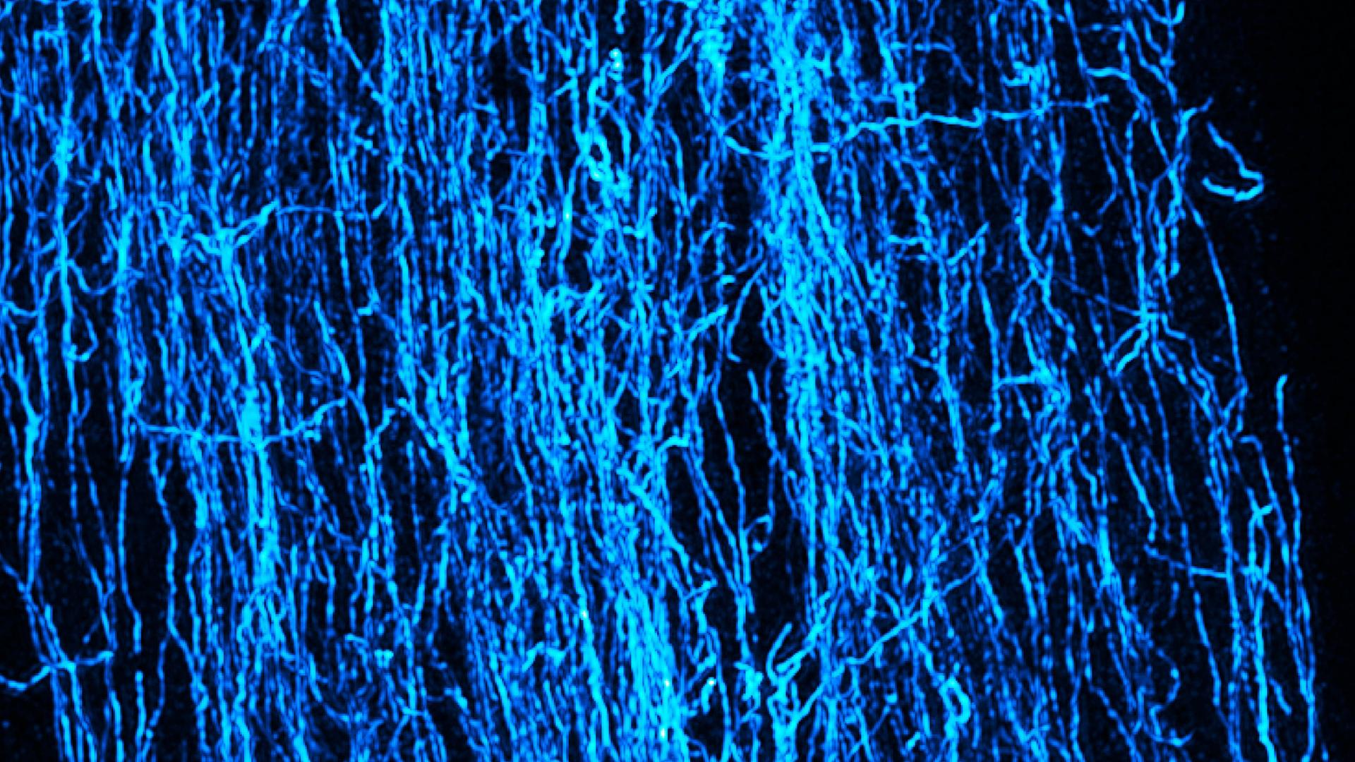 Visualization of the aspect ratio of the pore space in a tensile specimen.