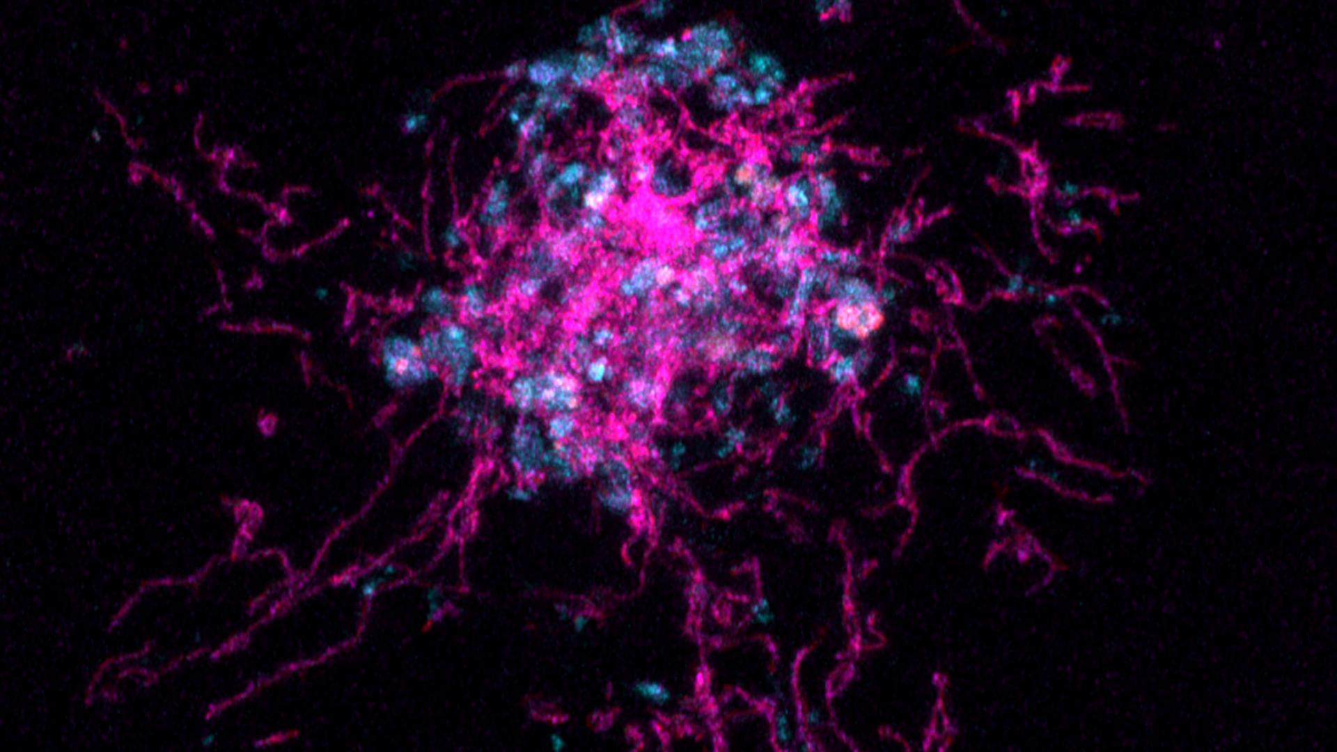 MDA MDA 231 breast cancer cells with RFP-tagged mitochondria labelled with MitoTracker Deep Red (magenta) and LysoTracker (cyan).