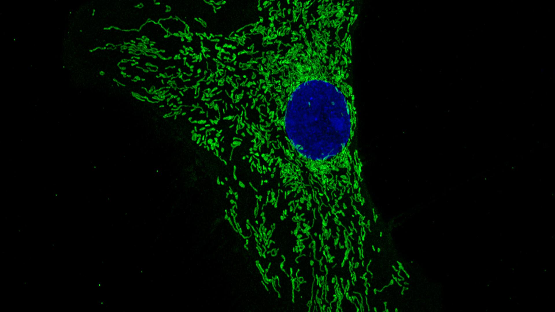 Mitochondrial fragmentation