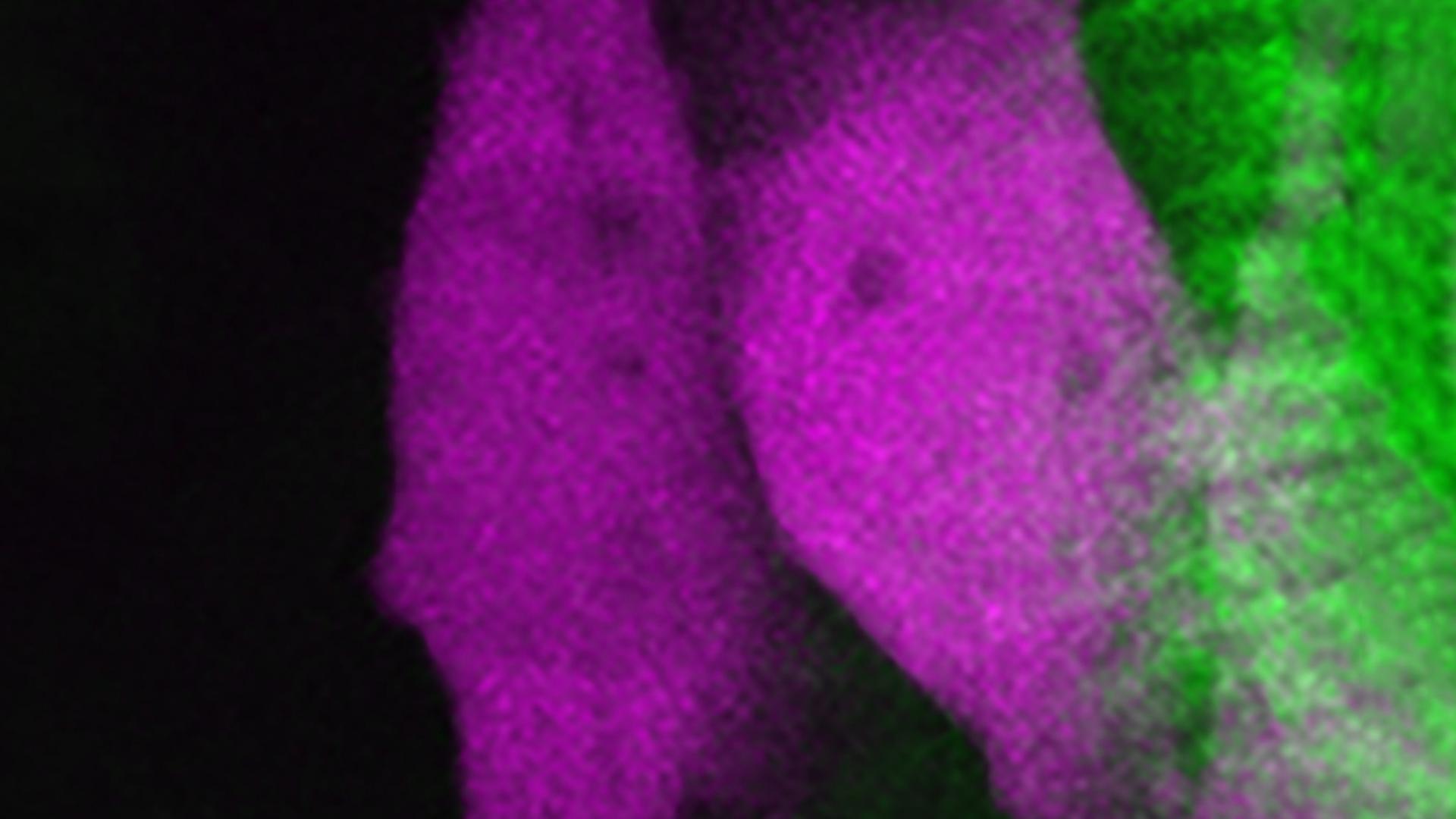 Cancer cells interacting with matrix in vivo. 