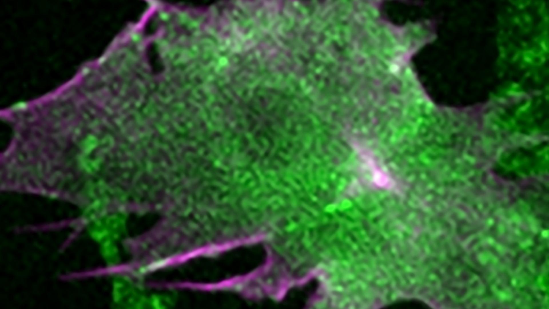 Cancer cells form focal adhesion structures at the base of actin-rich protrusions.