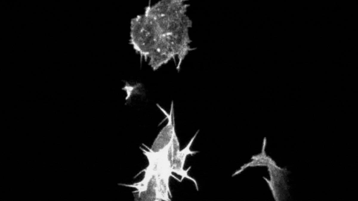 Cancer cells form actin-rich structures during cell migration in vivo