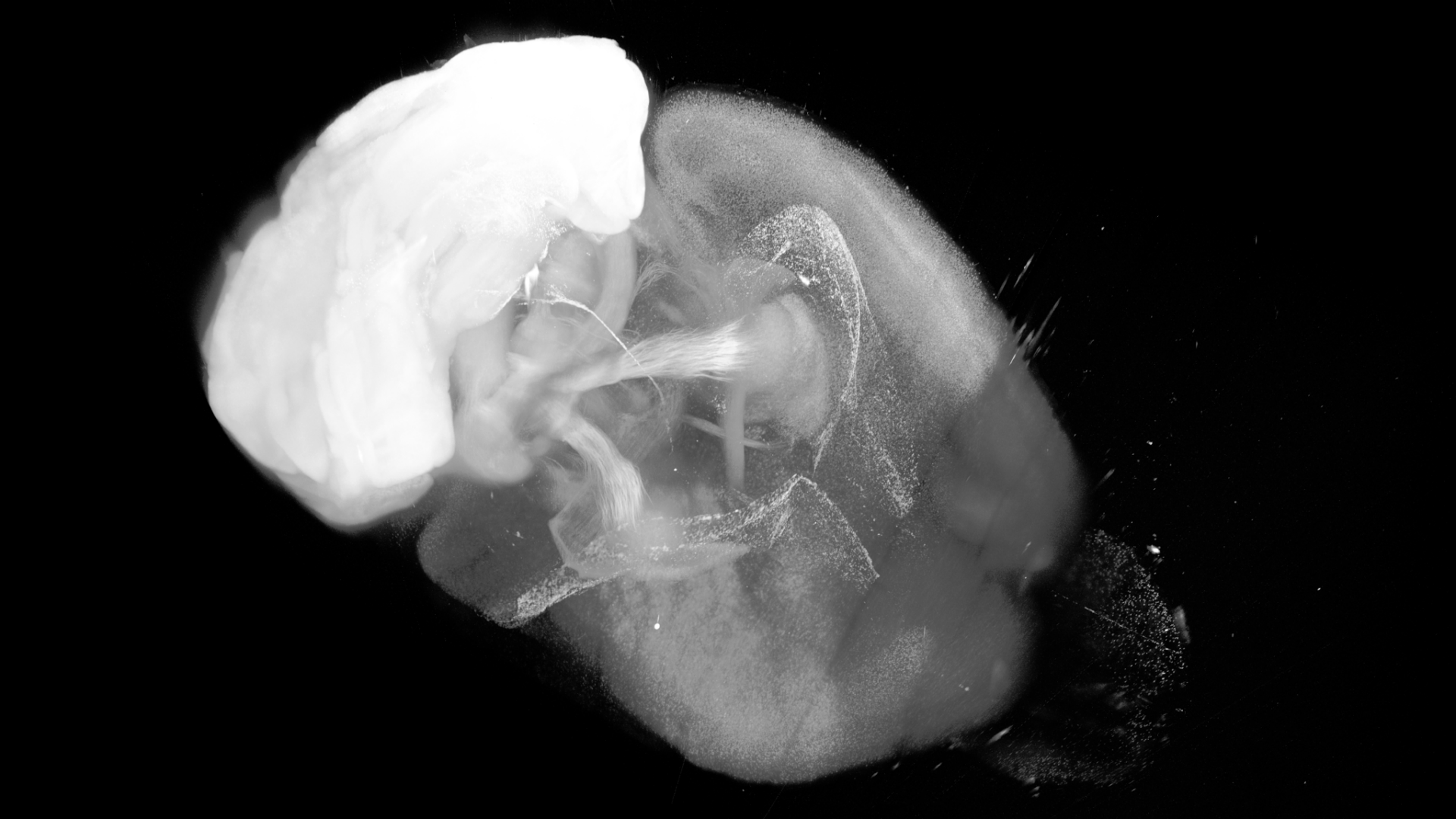 PV-tdtomato (Parvalbumin-Cre yielding expression of tdtomato - Parvalbumin is expressed in a population of interneurons throughout the brain and in Purkinje cells in the cerebellum) mouse brain cleared using CLARITY protocol with final imaging done in EasyIndex.