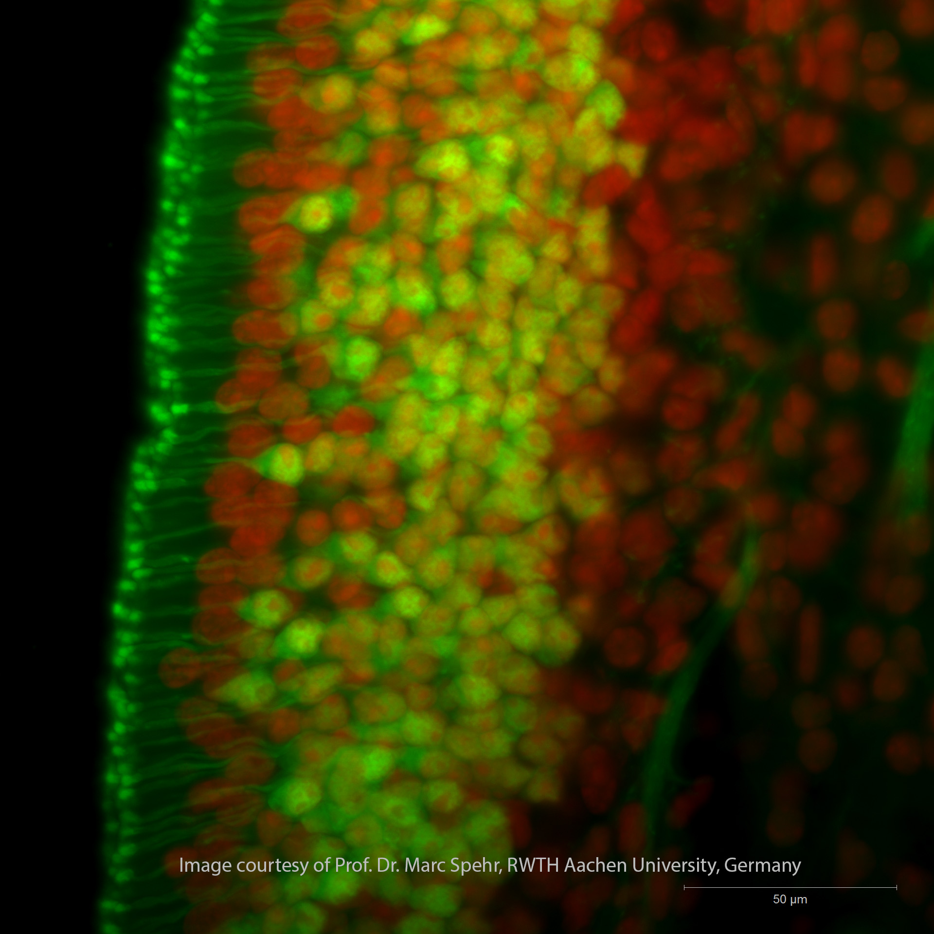 Image credit: Mitochondria in the cerebellum;  (C) Caroline Fecher