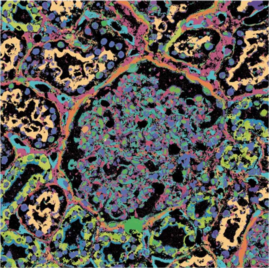 Webinar | Pathology-oriented multplexing