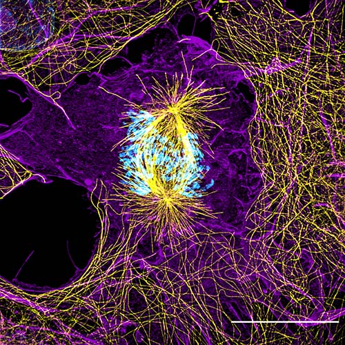Image credit: Mitochondria in the cerebellum;  (C) Caroline Fecher