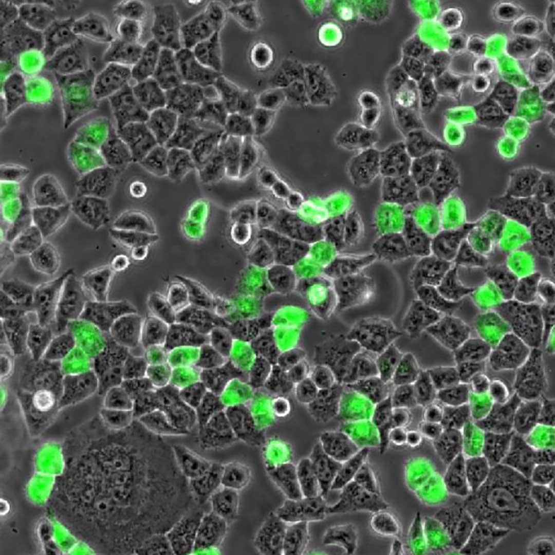 Soluciones de microscopía para cultivos celulares