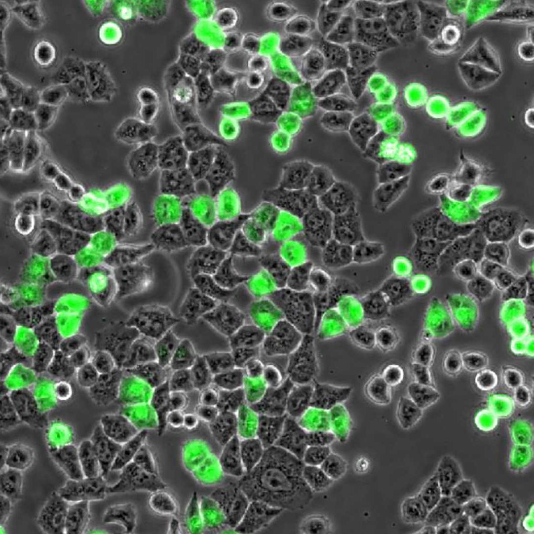 Soluciones de microscopía para cultivo celular