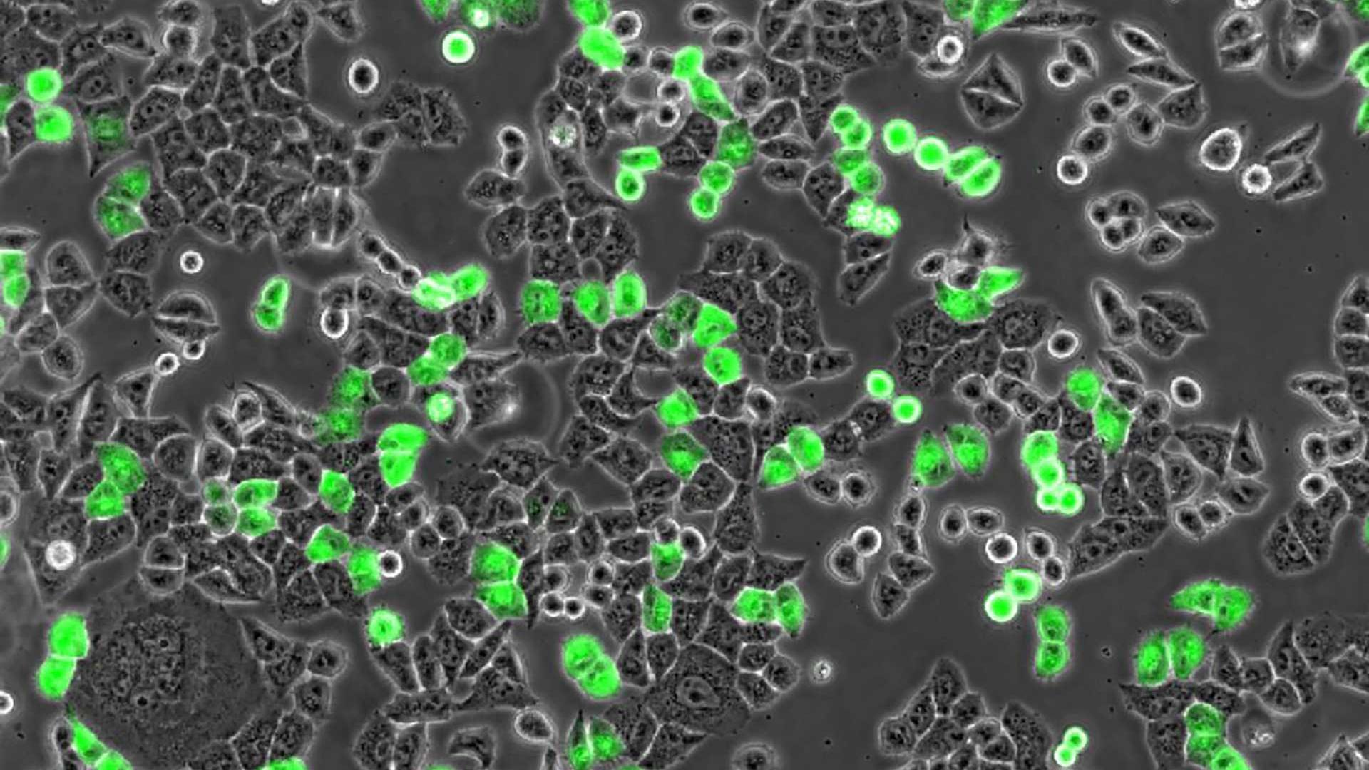 Soluciones de microscopía para cultivos celulares