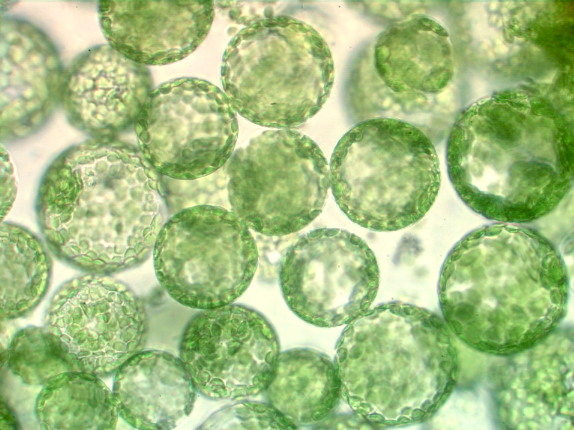 Protoplastes de tabac, image à fond clair acquise avec Axiovert