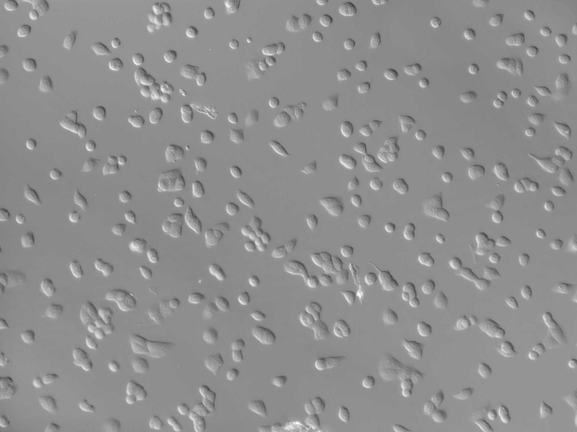 MDCK-Zellen (Hund) nach kurzer Inkubationszeit, aufgenommen mit Axio Observer