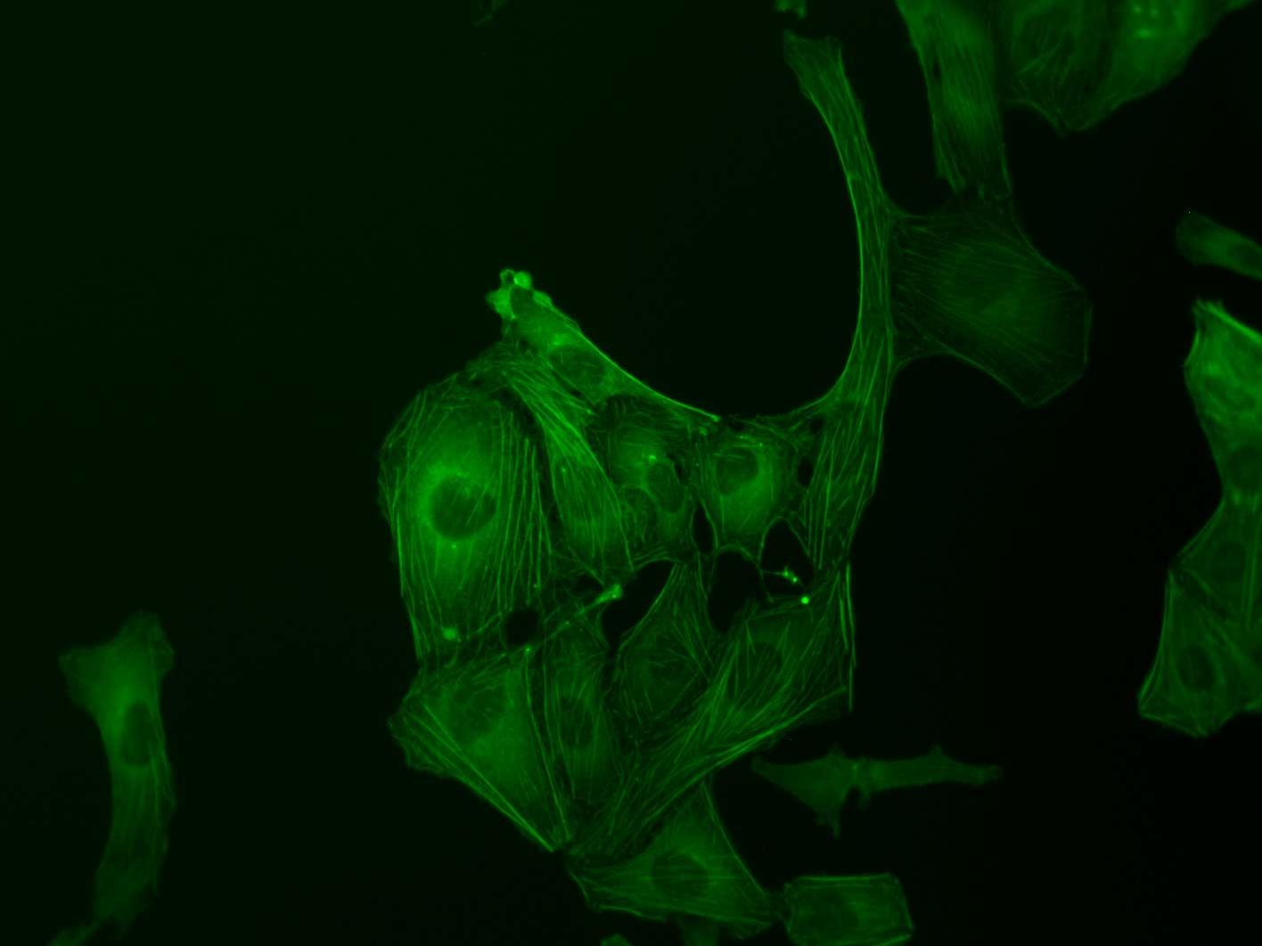 U2OS cells imaged in live cell culture, GFP Actin stained.