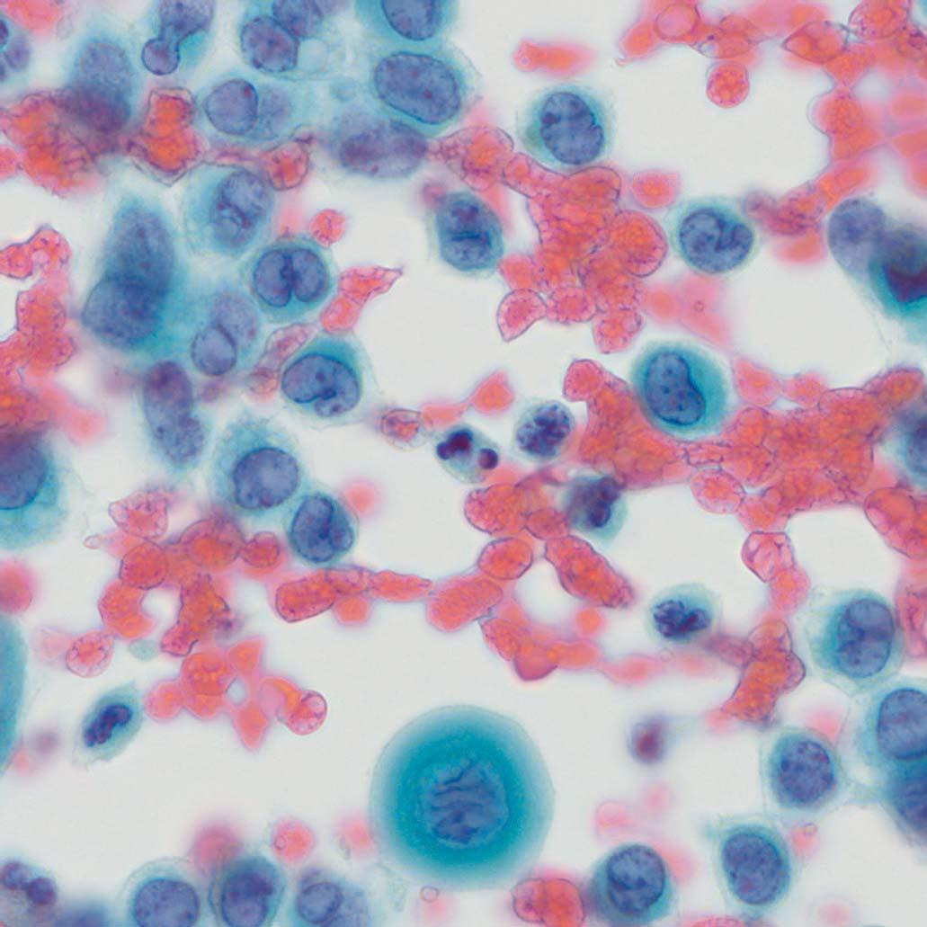 Soluciones de microscopía para citología y citopatología