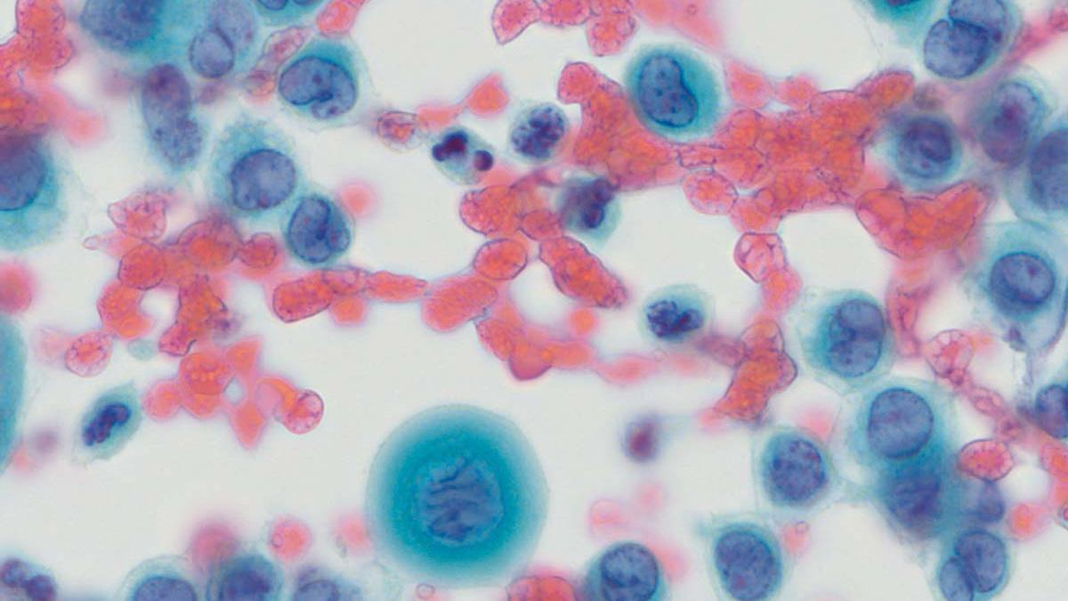 Microscopic view of diseases on a celullar level