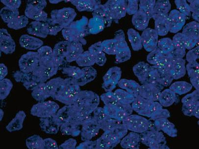 Fluorescence her2 centromere