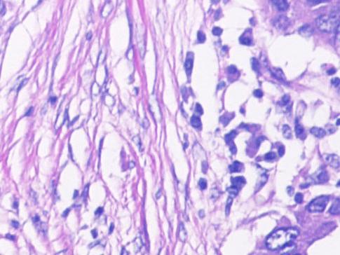 Histologie des poumons 