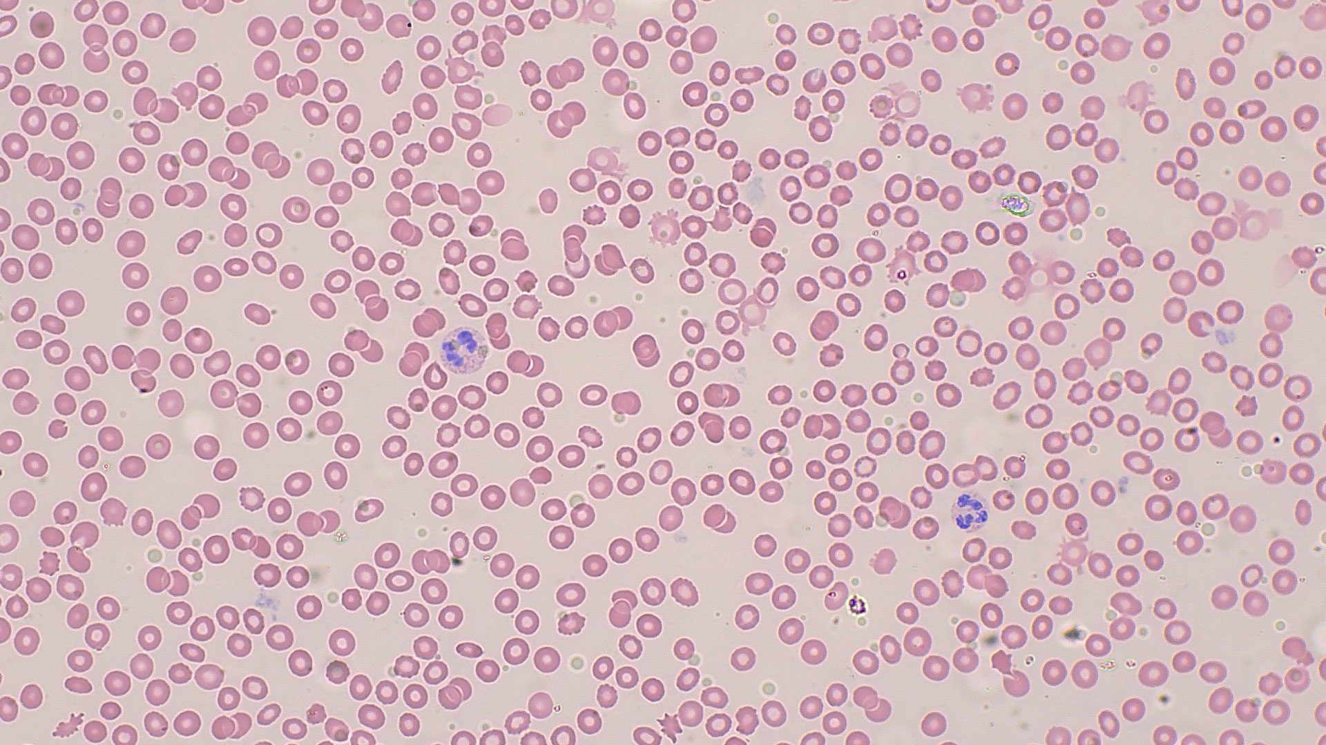 Microscopic view of blood smears