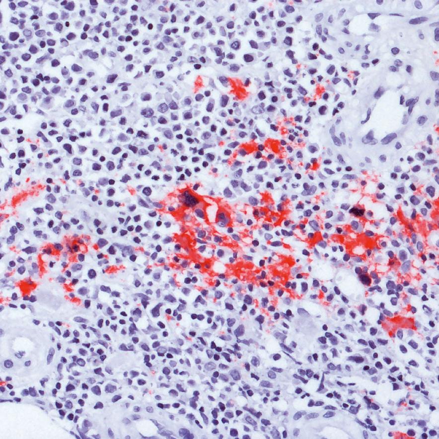 Solutions de microscopie pour l'histologie et l'histopathologie