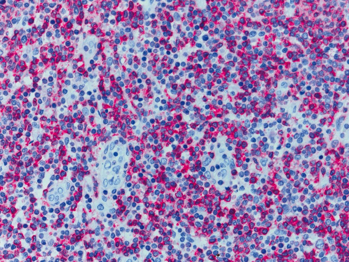 Histological specimen (human), CDx immunohistological stain