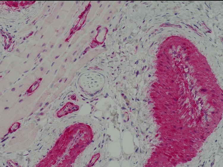 Inmunohistología, tinción HE, piel, actina de músculo liso. 