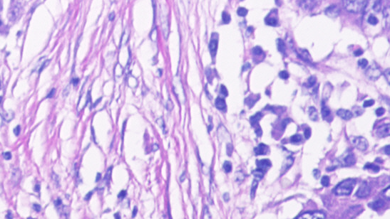 Microscopic view of tissue architecture