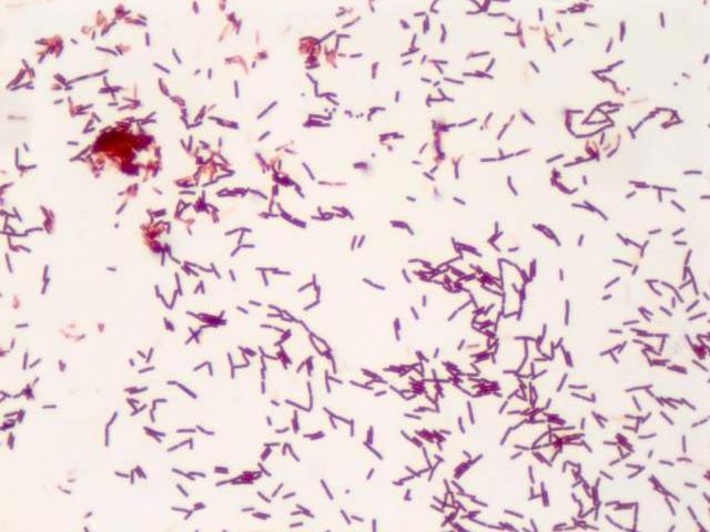 Stäbchenbakterium mit Gram-Färbung