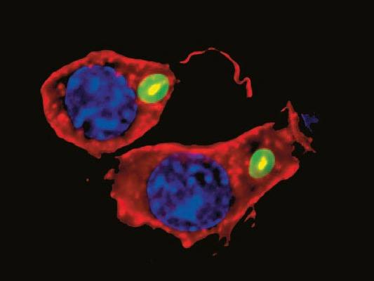 Macrophage with F-actin (phalloidin-Alexa 568) and nucleoli (DAPI) surrounded by S.aureus bacteria (green). Courtesy of Dr. H. Wolff, GSF Institute of Molecular Virology, Munich, Germany. 