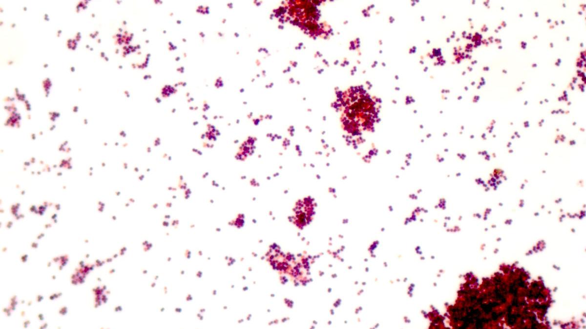 Microscopy Solutions for Microbiology